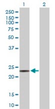 Anti-PEMT antibody produced in rabbit purified immunoglobulin, buffered aqueous solution