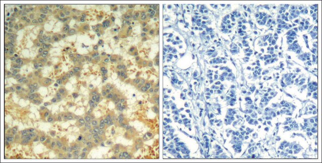 Anti-phospho-SYK (pTyr323) antibody produced in rabbit affinity isolated antibody