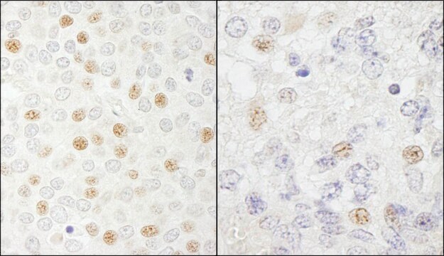 Rabbit anti-CDC20 Antibody, Affinity Purified Powered by Bethyl Laboratories, Inc.