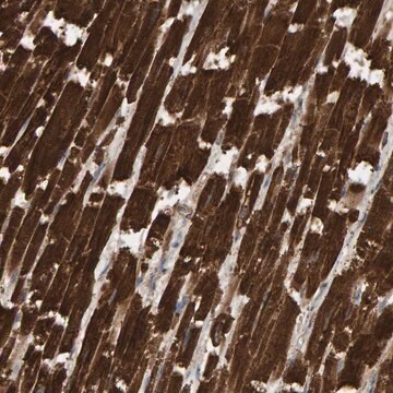 Anti-DUS1L antibody produced in rabbit Prestige Antibodies&#174; Powered by Atlas Antibodies, affinity isolated antibody, buffered aqueous glycerol solution