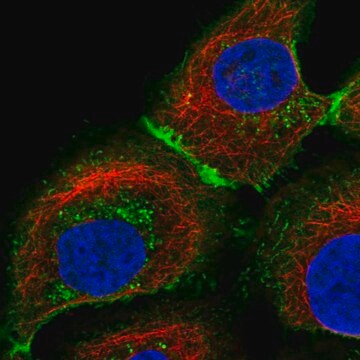 Anty-SLC16A1 affinity isolated antibody