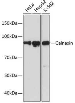 Anti-Calnexin Antibody, clone 5S3U3, Rabbit Monoclonal