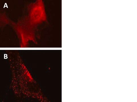 LentiBrite RFP-p62 Lentiviral Biosensor