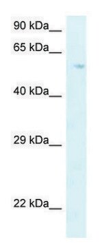 Anti-P4HA2 (C-terminal) antibody produced in rabbit affinity isolated antibody