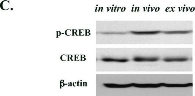 Anticorpo antifosfo-CREB (Ser133) Upstate&#174;, from rabbit