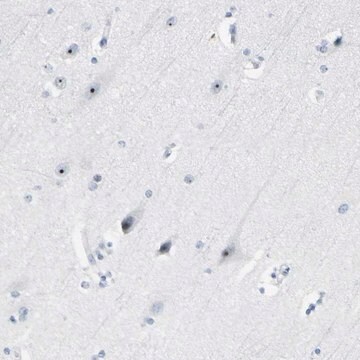 Anti-ZSCAN1 antibody produced in rabbit Prestige Antibodies&#174; Powered by Atlas Antibodies, affinity isolated antibody, buffered aqueous glycerol solution