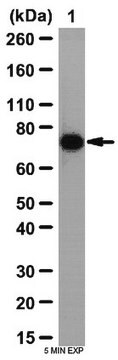 Anti-BMPR-1A Antibody from rabbit, purified by affinity chromatography