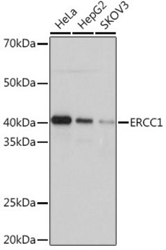 Anti-ERCC1 Antibody, clone 5F9U0, Rabbit Monoclonal