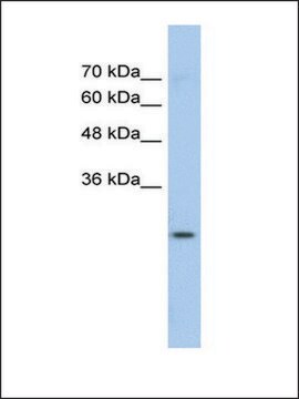 Anti-GSTM1 antibody produced in rabbit affinity isolated antibody