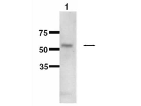 Przeciwciało przeciwko cytochromowi P450 1B1 serum, Chemicon&#174;