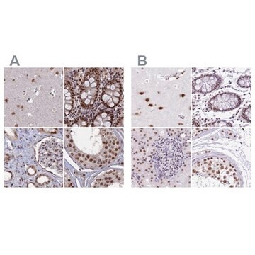 Anti-SF3A2 antibody produced in rabbit Prestige Antibodies&#174; Powered by Atlas Antibodies, affinity isolated antibody, buffered aqueous glycerol solution