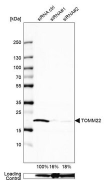 抗TOMM22抗体 ウサギ宿主抗体 affinity isolated antibody, buffered aqueous glycerol solution