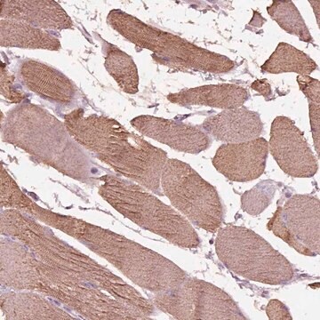 Anti-NMRK2 antibody produced in rabbit Prestige Antibodies&#174; Powered by Atlas Antibodies, affinity isolated antibody