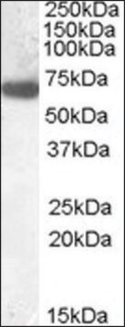 Anti-GCKR (N-terminal) antibody produced in goat affinity isolated antibody, buffered aqueous solution