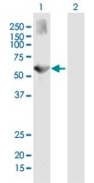 Anti-ALKBH5 antibody produced in mouse purified immunoglobulin, buffered aqueous solution