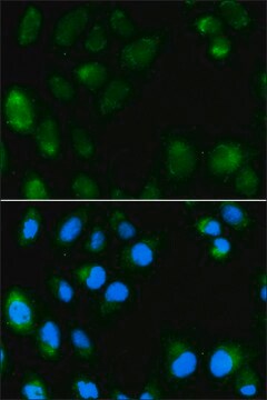 Anti-UCP3 antibody produced in rabbit affinity isolated antibody