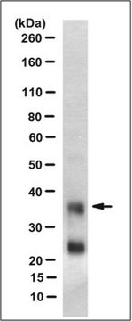 Anti-PrP, clone DRM1-31 Antibody clone DRM1-31, from mouse