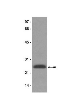 Anticuerpo anti-HP1&#947;, clon 42s2 clone 42s2, Upstate&#174;, from mouse