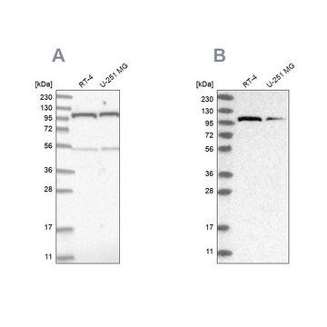 Anti-OGT Prestige Antibodies&#174; Powered by Atlas Antibodies, affinity isolated antibody