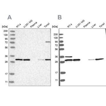 Anti-RPA2 antibody produced in rabbit Prestige Antibodies&#174; Powered by Atlas Antibodies, affinity isolated antibody, buffered aqueous glycerol solution, ab2