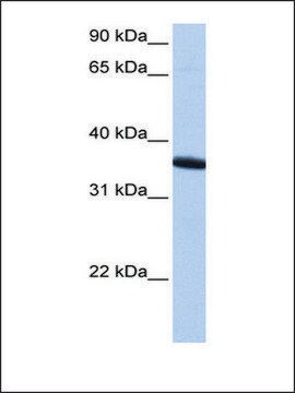 Anti-ZNF389 antibody produced in rabbit affinity isolated antibody