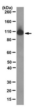 Anticorps anti-MSH2, clone&nbsp;FE11 clone FE11, from mouse