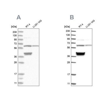 Anti-TCP1 antibody produced in rabbit Prestige Antibodies&#174; Powered by Atlas Antibodies, affinity isolated antibody, buffered aqueous glycerol solution, ab1