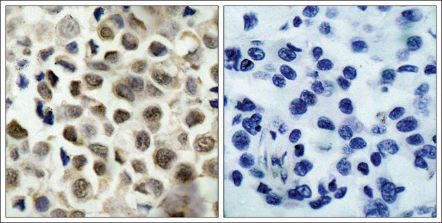 Anti-phospho-HDAC8 (pSer39) antibody produced in rabbit affinity isolated antibody