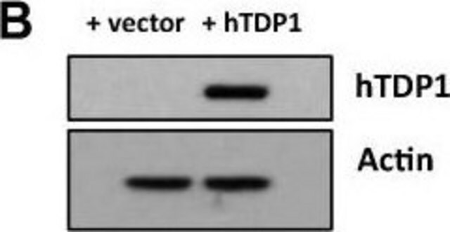 Monoklonales Anti-Aktin in Maus hergestellte Antikörper clone AC-40, ascites fluid