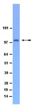 Anti-QIK (SIK2) Antibody Upstate&#174;, from rabbit