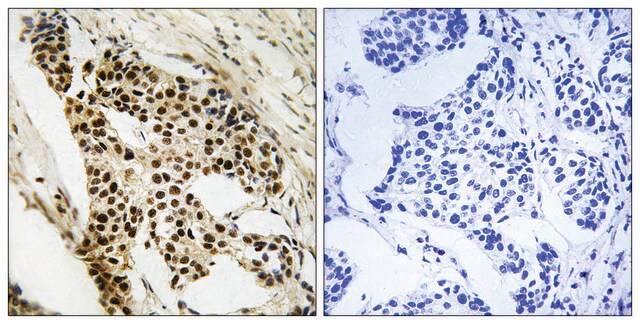 Anti-MAPKAPK2 antibody produced in rabbit affinity isolated antibody