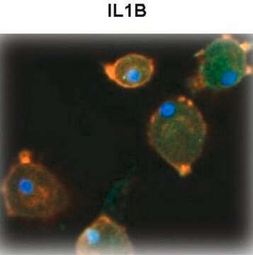 Anti-IL1&#946; Antibody, clone 7E1S4, Rabbit Monoclonal