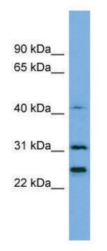 Anti-HIST1H1E (N-terminal) antibody produced in rabbit affinity isolated antibody