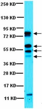 Anti-CaM Kinase II Antibody from rabbit, purified by affinity chromatography