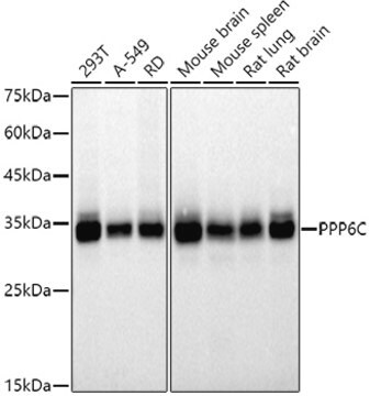 Anti-PPP6C Antibody, clone 6O2N8, Rabbit Monoclonal