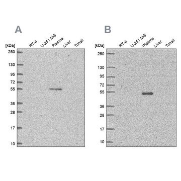 Anti-EED antibody produced in rabbit Prestige Antibodies&#174; Powered by Atlas Antibodies, affinity isolated antibody