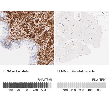 抗FLNA ウサギ宿主抗体 Ab3, Prestige Antibodies&#174; Powered by Atlas Antibodies, affinity isolated antibody, buffered aqueous glycerol solution