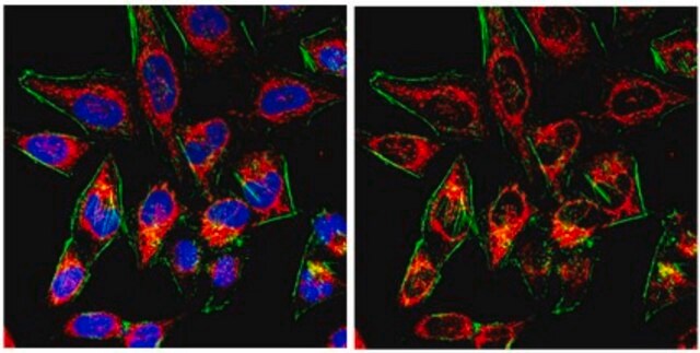 Anti-Probable ergosterol biosynthetic protein 28 Antibody from rabbit, purified by affinity chromatography