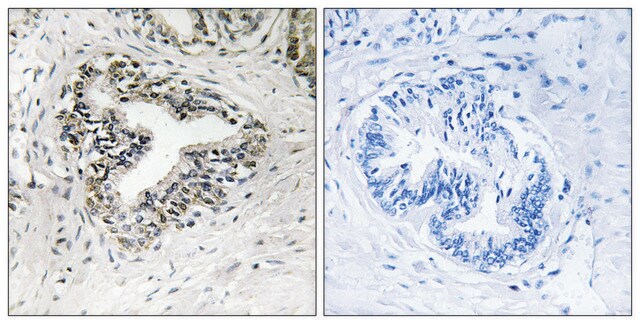 Anti-RPL30 antibody produced in rabbit affinity isolated antibody