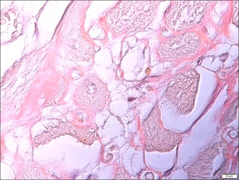 Amyloid TISSUE-TROL&#8482; Control Slides from human heart