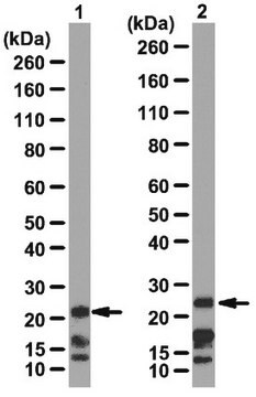 Przeciwciało anty-Cbx7 from rabbit, purified by affinity chromatography