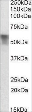 Anti-Serpina6 antibody produced in goat affinity isolated antibody, buffered aqueous solution