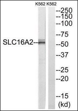 Anti-SLC16A2 antibody produced in rabbit affinity isolated antibody