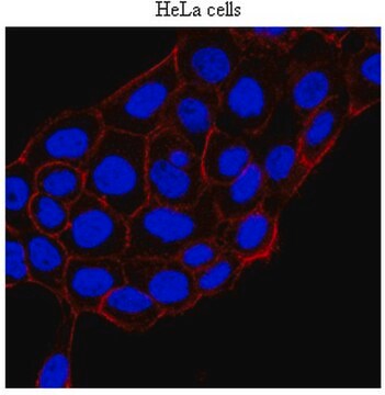 Anti-KRIT-1 Antibody, clone 15 clone 15B2, from mouse