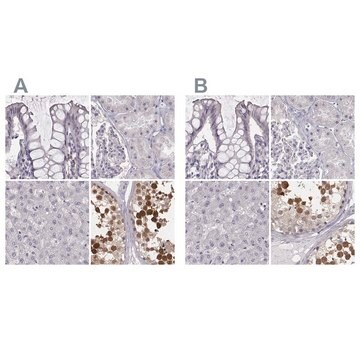 Anty-PBK Prestige Antibodies&#174; Powered by Atlas Antibodies, affinity isolated antibody