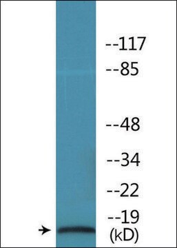 Anti-phospho-STMN1 (pSer62) antibody produced in rabbit affinity isolated antibody