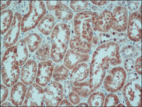 Anti-IDH1 (C-terminal) antibody produced in rabbit ~1.0&#160;mg/mL, affinity isolated antibody