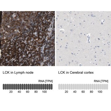 Anti-LCK antibody produced in rabbit Prestige Antibodies&#174; Powered by Atlas Antibodies, affinity isolated antibody, buffered aqueous glycerol solution