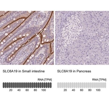 Anti-SLC6A19 antibody produced in rabbit Prestige Antibodies&#174; Powered by Atlas Antibodies, affinity isolated antibody, buffered aqueous glycerol solution