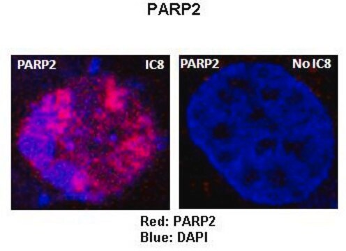 抗PARP2抗体 affinity isolated antibody